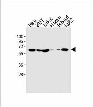 IFNAR1 Antibody (Center)