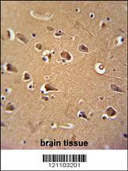 CALM1 Antibody (C-term)