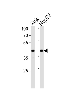 LRPAP1 Antibody (C-term)