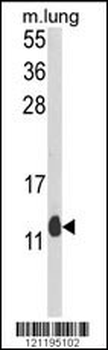 PEA-15 Antibody (C-term)