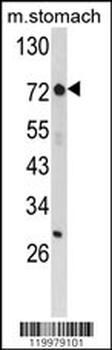 ZFP36 Antibody (Center)