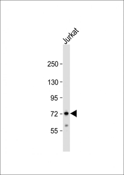 ZFP36 Antibody (Center)