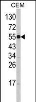 SLC11A1 Antibody (Center)