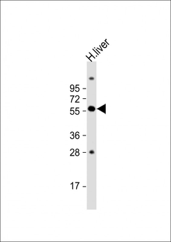 SLC11A1 Antibody (Center)