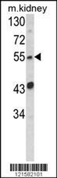 SIL1 Antibody (Center)