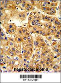 SIL1 Antibody (Center)