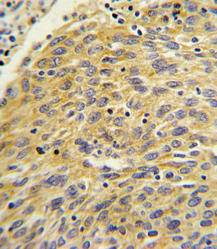 PLA2G4A Antibody (Center)