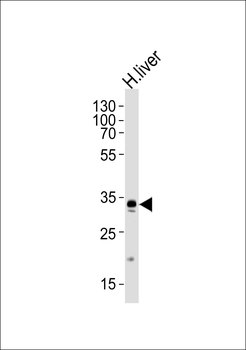 GPD1 Antibody (N-term)