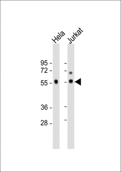 PP5 Antibody (C-term)