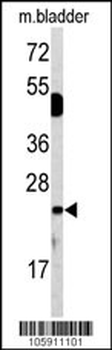 DUSP14 Antibody (N-term)