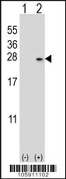 DUSP14 Antibody (N-term)