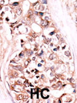 DUSP14 Antibody (N-term)