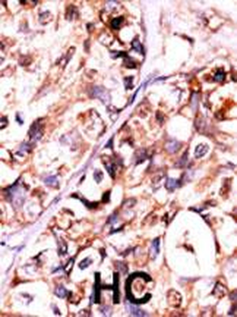 DUSP8 Antibody (N-term)