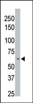 PPM1D Antibody (C-term)
