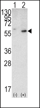 PTEN Antibody (N-term)