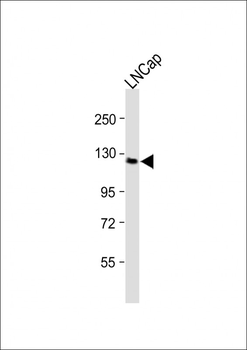 TRPM8 Antibody (C-term C940)