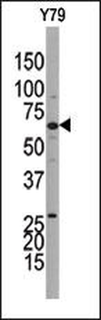 Guanylyl Cyclase beta 1 (GUCY1B3) Antibody (C-term)