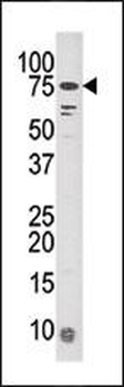 SAD1 (BRSK1) Antibody (N-term)