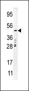 Urokinase (PLAU) Antibody (C-term)