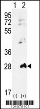 AK1 Antibody (N-term)
