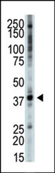 TRIB3 Antibody (C-term)