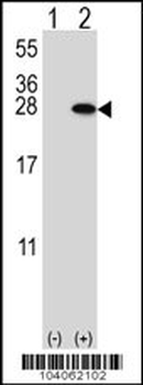 YWHAB Antibody (N-term)