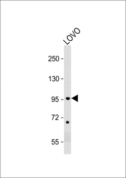 EPS8 Antibody (N-term)