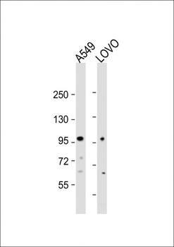EPS8 Antibody (N-term)