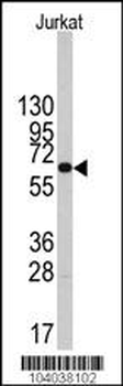 PFKFB1 Antibody (Center)