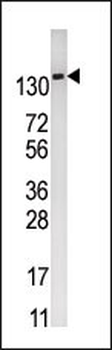 PFKFB2 Antibody (N-term)