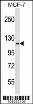 HK1 (Hexokinase) Antibody (N-term)