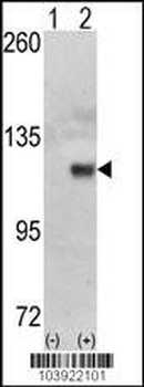 HK1 (Hexokinase) Antibody (N-term)