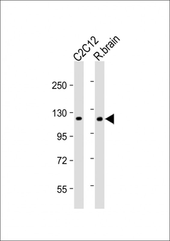 HK1 (Hexokinase) Antibody (N-term)