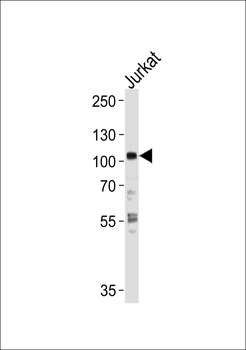 HK2 (Hexokinase II) Antibody (Center)
