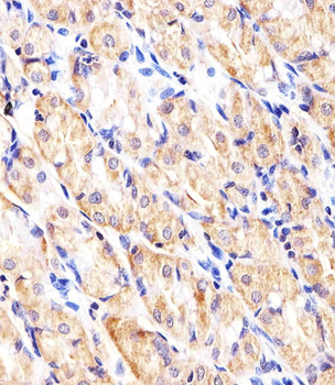 HK2 (Hexokinase II) Antibody (Center)