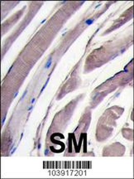 HK2 (Hexokinase II) Antibody (N-term)