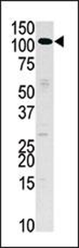 HK3 (Hexokinase III) Antibody (N-term)