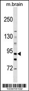 HK3 (Hexokinase III) Antibody (C-term)