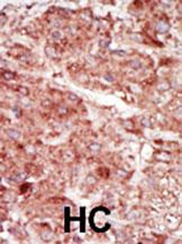 HK3 (Hexokinase III) Antibody (C-term)