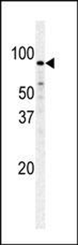 Fructose 6 Phosphate Kinase (PFKM) Antibody (C-term)