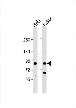 PFKP Antibody (C-term)