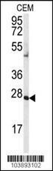 AK2 Antibody (N-term)