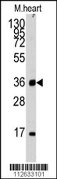 ULK3 Antibody (N-term)
