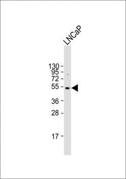 ULK3 Antibody (N-term)