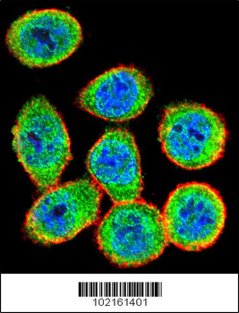 IKK beta Antibody