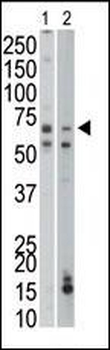 PCK1 Antibody (C-term)