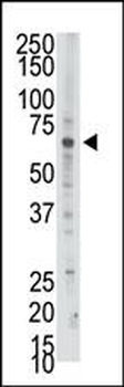 PAPSS2 Antibody (C-term)