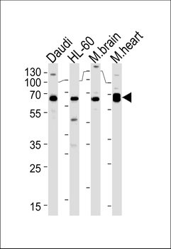 PACSIN2 Antibody (C-term)