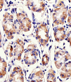 PACSIN2 Antibody (C-term)
