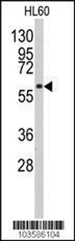 PACSIN1 Antibody (N-term)